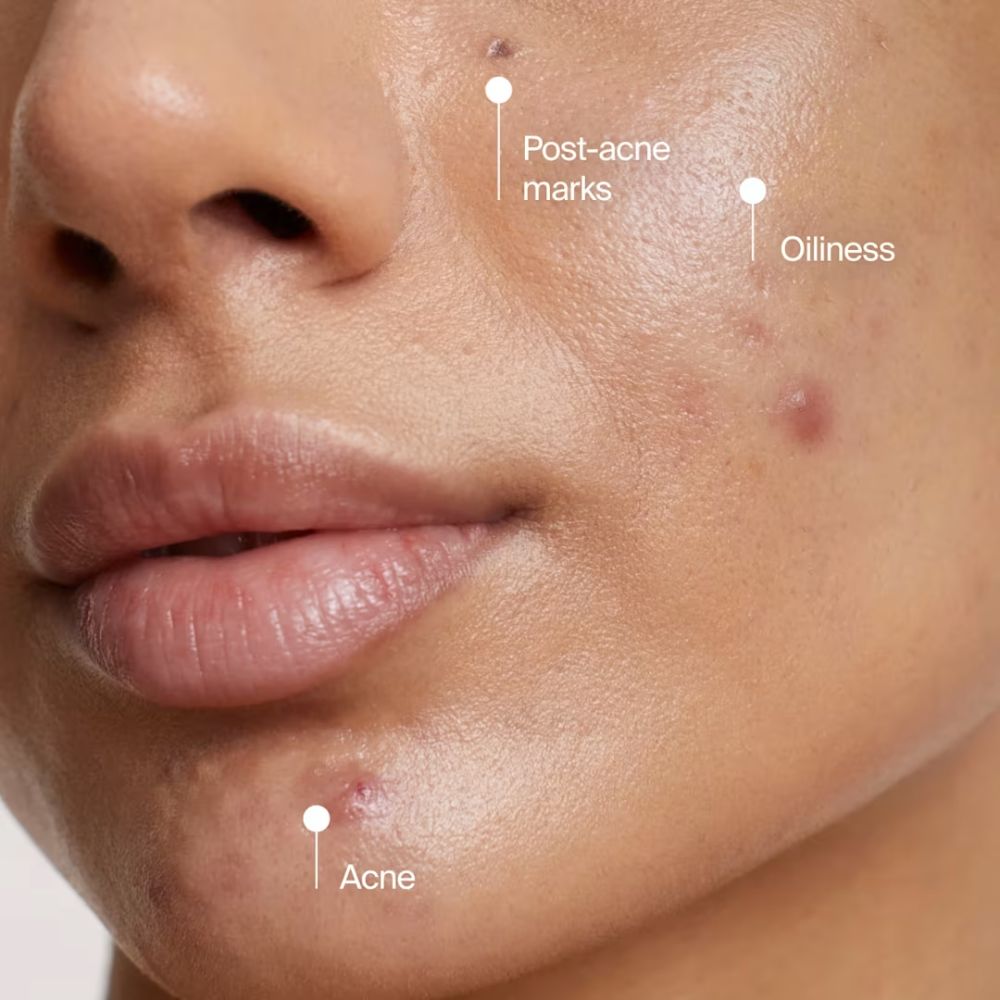 neutrogena evenly clear acne cleansing mask 125ml - 3