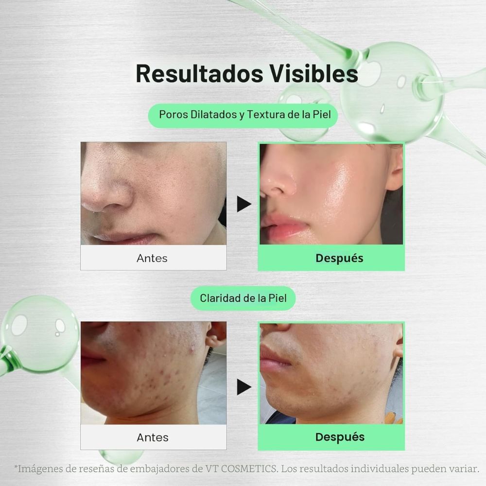 vt cosmetics reedle shot 700 cica reedle 30ml - 2