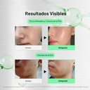 vt cosmetics reedle shot 700 cica reedle 30ml - 2