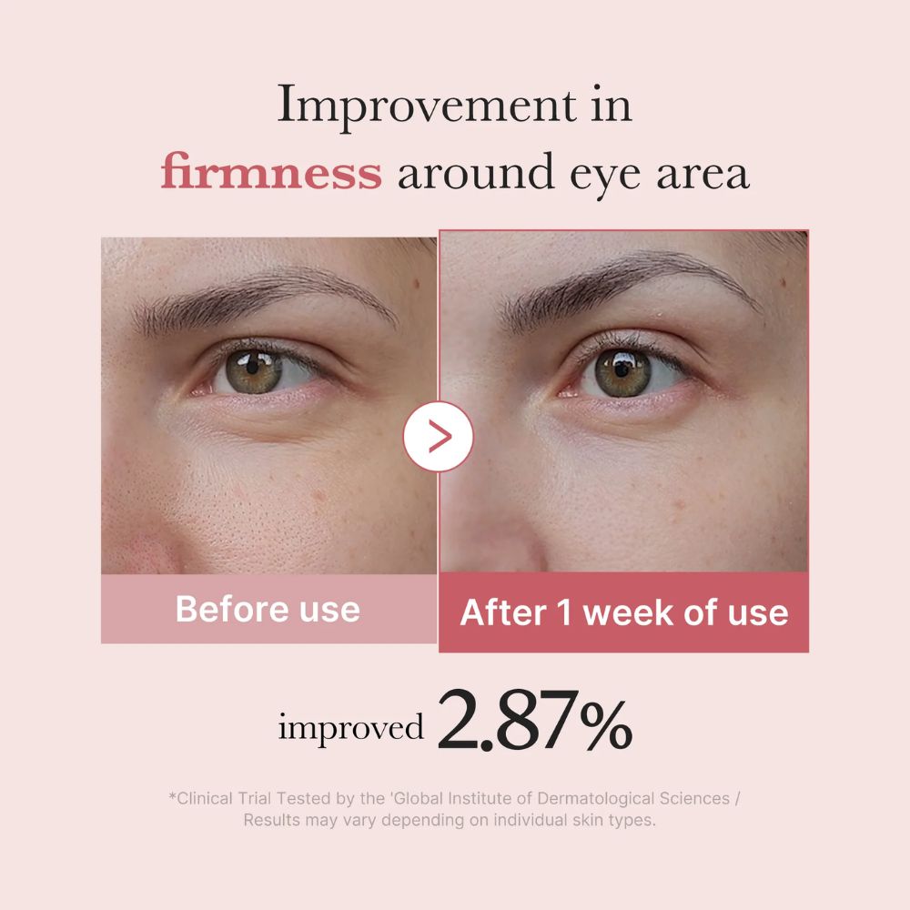 medicube pdrn pink peptide eye cream 30ml - 2