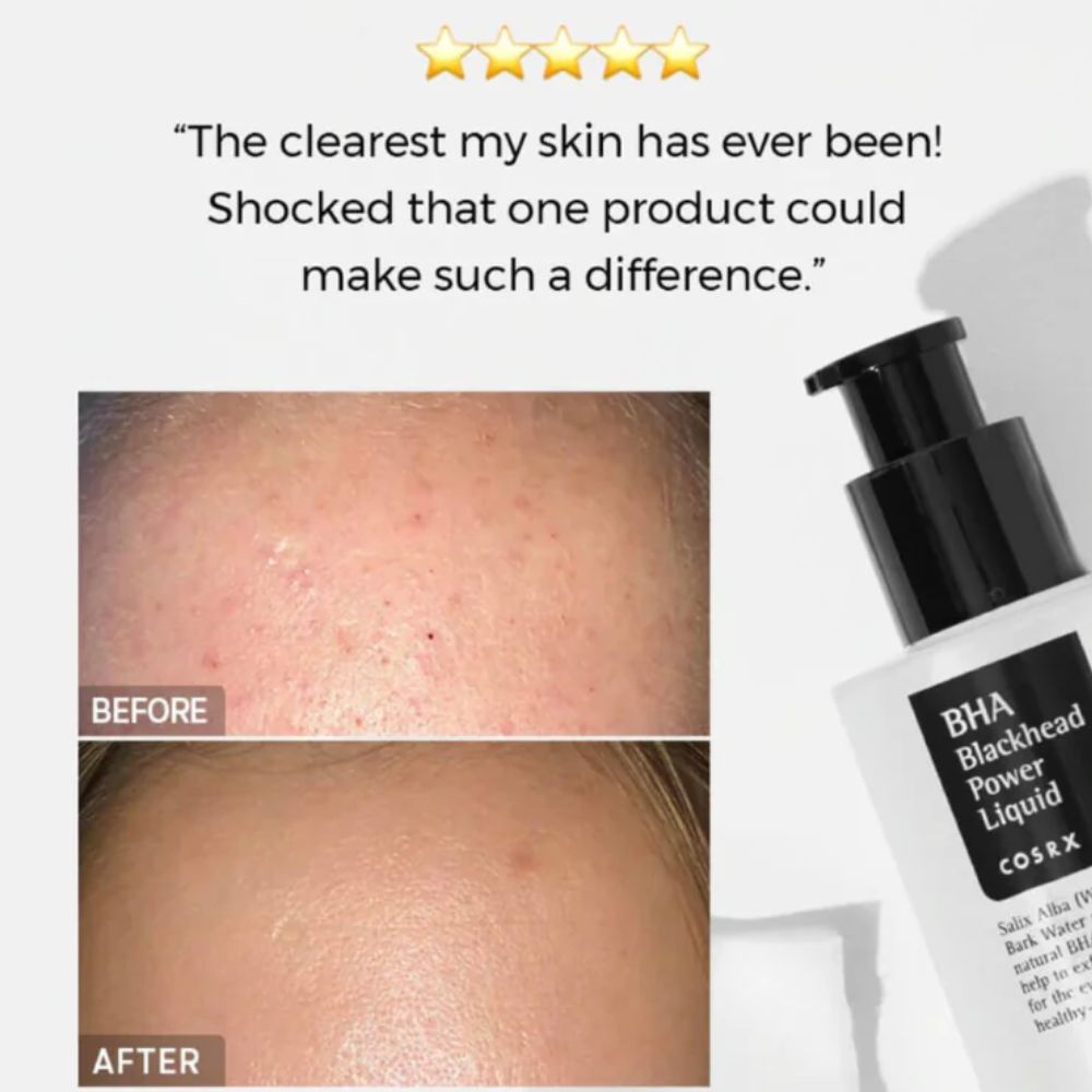 cosrx bha blackhead power liquid 100ml - 2