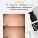 cosrx bha blackhead power liquid 100ml - 2