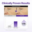 centellian 24 360° shot pdrn active serum 50ml - 2
